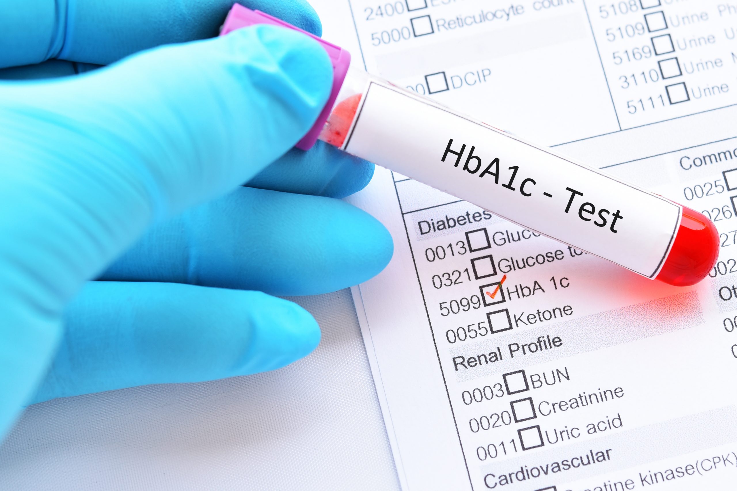 What Tests For Type 1 Diabetes